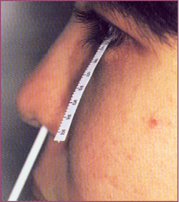 眼表眼角膜,希瑪瑞視眼科,上海眼科醫(yī)院 眼表眼角膜,希瑪瑞視眼科,上海眼科醫(yī)院