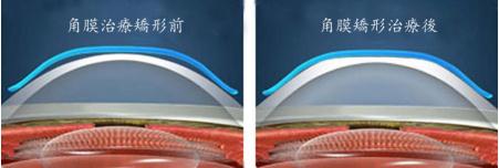 醫學驗光配鏡,希瑪瑞視眼科,上海眼科醫院 醫學驗光配鏡,希瑪瑞視眼科,上海眼科醫院