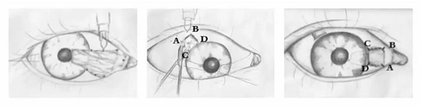 眼表眼角膜,希瑪瑞視眼科,上海眼科醫院