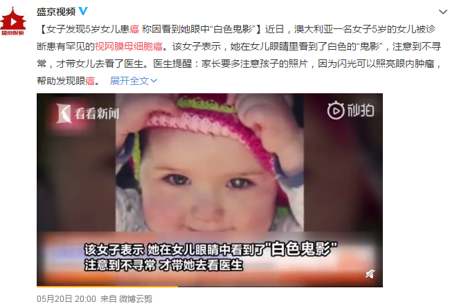 眼眶病,?，斎鹨曆劭?上海眼科醫院