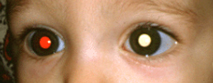 眼眶病,?，斎鹨曆劭?上海眼科醫院