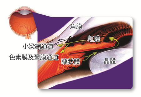 青光眼,?，斎鹨曆劭?上海眼科醫院