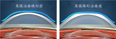 小兒眼病,希瑪瑞視眼科,上海眼科醫院 小兒眼病,希瑪瑞視眼科,上海眼科醫院