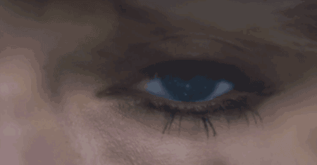 青光眼,希瑪瑞視眼科,上海眼科醫(yī)院