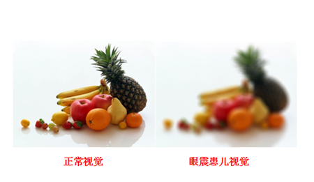 小兒眼病,?，斎鹨曆劭?上海眼科醫院