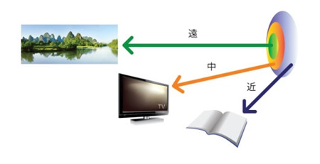 白內(nèi)障,希瑪瑞視眼科,上海眼科醫(yī)院