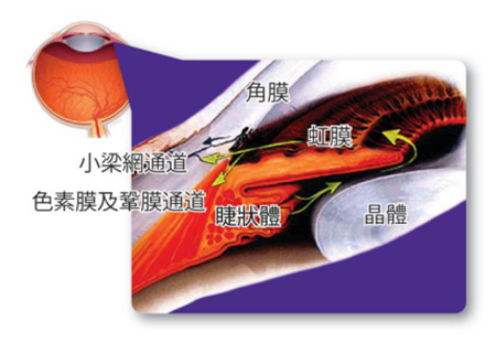 青光眼,希瑪瑞視眼科,上海眼科醫院