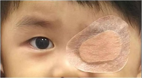 小兒眼病,希瑪瑞視眼科,上海眼科醫(yī)院