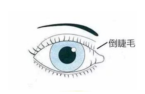 眼表眼角膜,?，斎鹨曆劭?上海眼科醫(yī)院