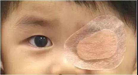 小兒眼病,希瑪瑞視眼科,上海眼科醫院