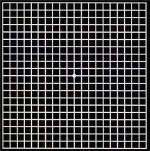 玻璃體視網膜,希瑪瑞視眼科,上海眼科醫院 玻璃體視網膜,希瑪瑞視眼科,上海眼科醫院