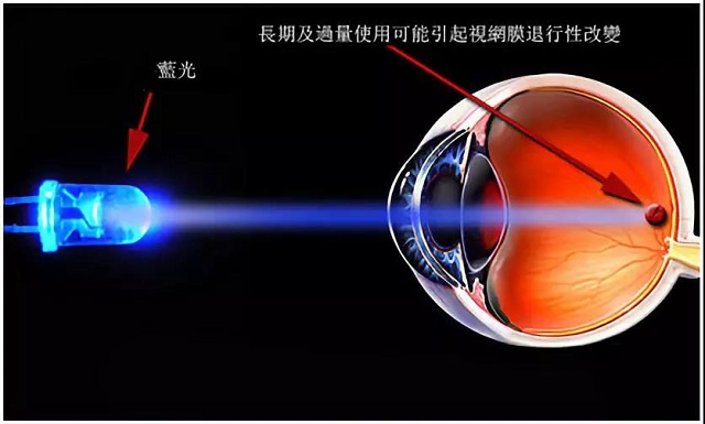 屈光矯視,希瑪瑞視眼科,上海眼科醫(yī)院