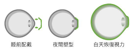 小兒眼病,希瑪瑞視眼科,上海眼科醫院