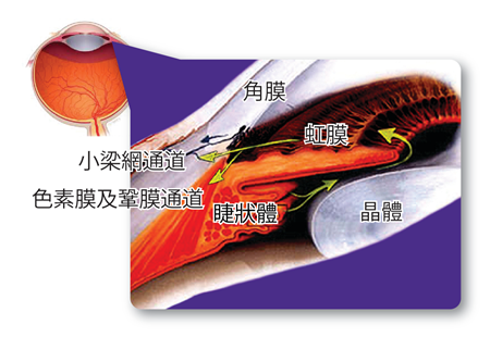 青光眼,?，斎鹨曆劭?上海眼科醫(yī)院