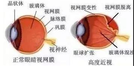 玻璃體視網(wǎng)膜,?，斎鹨曆劭?上海眼科醫(yī)院