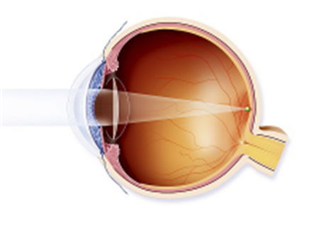 玻璃體視網膜,希瑪瑞視眼科,上海眼科醫院 玻璃體視網膜,希瑪瑞視眼科,上海眼科醫院