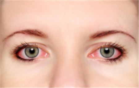 眼表眼角膜,希瑪瑞視眼科,上海眼科醫(yī)院