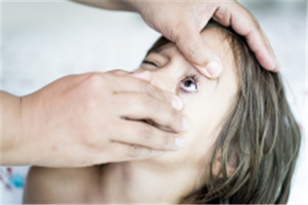 眼表眼角膜,希瑪瑞視眼科,上海眼科醫院