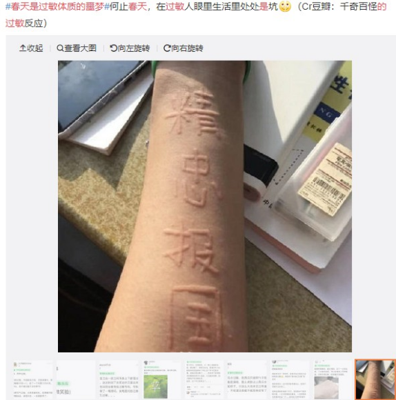 眼表眼角膜,希瑪瑞視眼科,上海眼科醫院 眼表眼角膜,希瑪瑞視眼科,上海眼科醫院