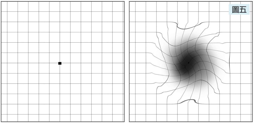 玻璃體視網膜,希瑪瑞視眼科,上海眼科醫院