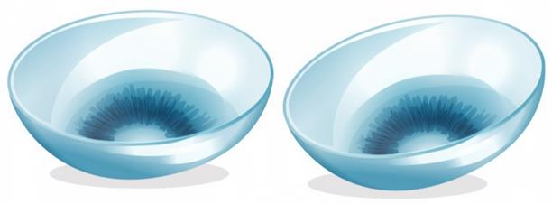 小兒眼病,希瑪瑞視眼科,上海眼科醫院