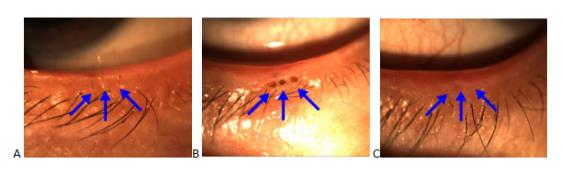 眼眶病,希瑪瑞視眼科,上海眼科醫院