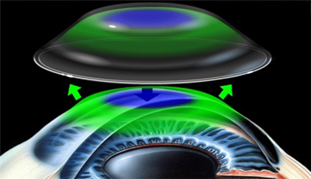 醫學驗光配鏡,?，斎鹨曆劭?上海眼科醫院