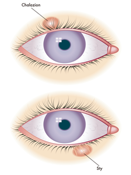 眼表眼角膜,希瑪瑞視眼科,上海眼科醫(yī)院